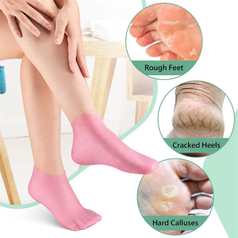 Silicone Moisturizing Gel Socks & Gloves Pack (64g) | Deep Repair for Dry Hands & Feet | Winter Care Deal - Image 4