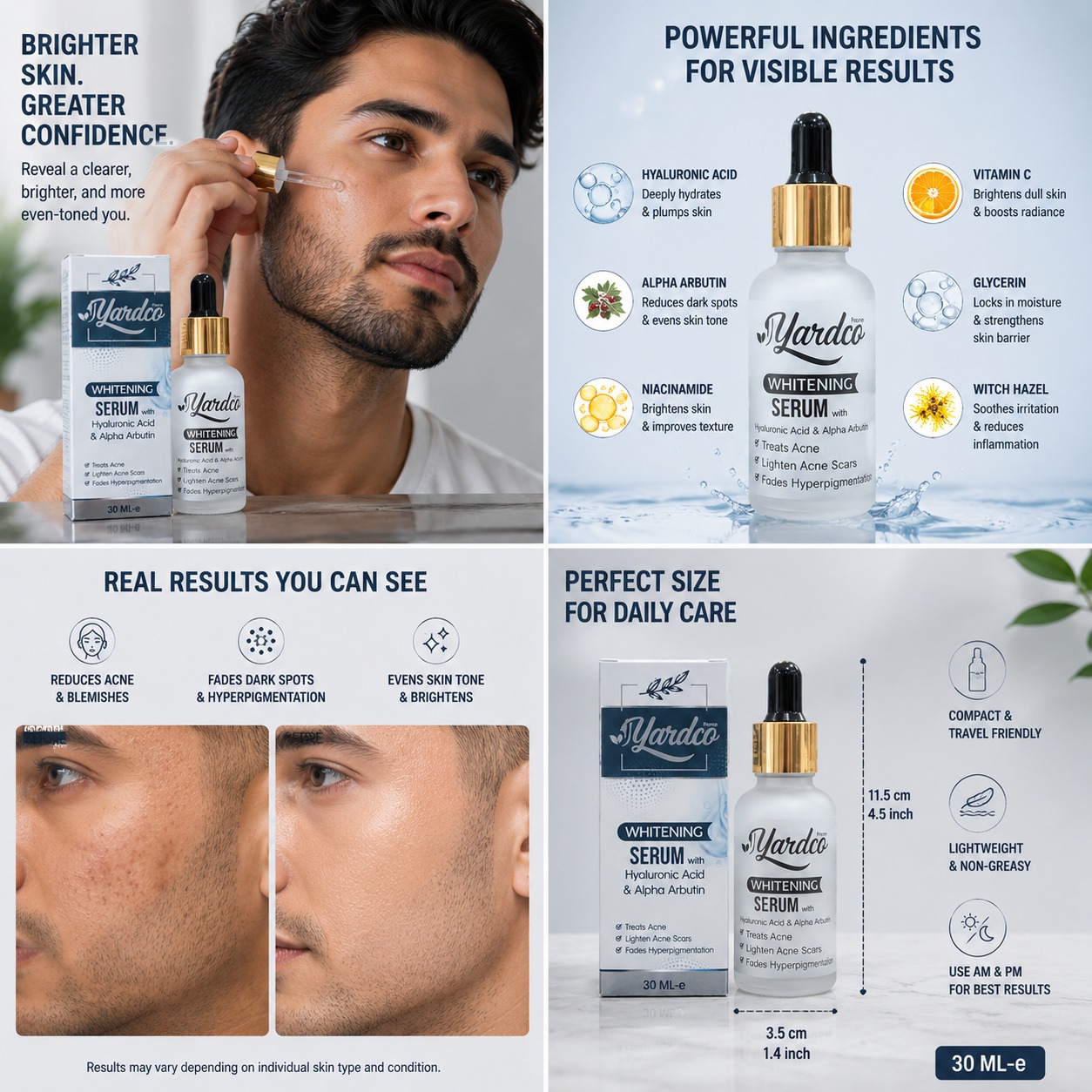Yardco Whitening Serum With Hyaluronic Acid And Alpha Arbutin Anti Acne And Dark Spot Corrector For Men 30ml - Image 4